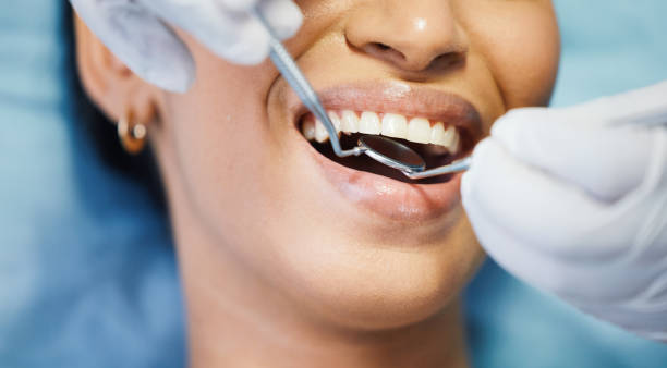 Best Emergency Gum Treatment in Lexington Park, MD